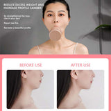 Removal of nasolabial folds to eliminate artifact facial tightening V face lifting face sagging face-lifting instrument facial