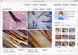 Hair Skin Iriscope Diagnosis Analyzer with Skin+Iris+Hair Analysis all in 1hine