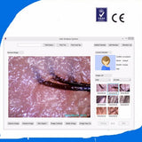 Hair Skin Iriscope Diagnosis Analyzer with Skin+Iris+Hair Analysis all in 1hine