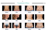 New Bestselling 80K Cavitation RF Ultrasonic Vacuum Weight Loss Body Slimming Beauty hine