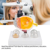 Enlarged Human Eye Anatomical Accurate Shows Optic Nerves Cornea Iris Lens Cataracts Eyeball Model