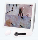 15inch LCD Skin&amp;Hair Analyzer Detector Digital Microscope Magnifier Skin Hair Blackhead Follicle Scalp Detector 50X-200X