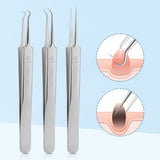 Medical Stainless Steel Blackhead Tweezers Pimple Comedone Remover Nipper Curved Bend Head Face Cleaner Acne Clip Beauty Tool