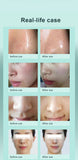 Multifunctional Face Cleaning Machine Hydrogen Oxygen Bubble Beauty Instrument Anti Wrinkle Ultrasound RF Lifting Skincare Tools