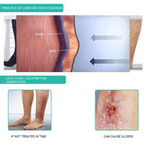1Pair Medical Compression 30-40mmHg Middle Tube Thin Calf Sleeve Peep-to Socks Pressure Varicose Veins Stockings For Woman