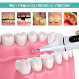 Whitening Oral Hygiene Tools Dental Scaler Ultrasonic Tartar Scraper Calculus Remover Electric Cordless Stains Cleaner Home