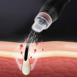 Multifunction Active Skin Management SPA Bubble Machine Blackhead Cleaning Face Whit Skin Rejuvenation Beauty Instrument