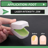 905NM Nail Therapeutic Instrument