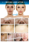 New Design Blackhead Remover Suction Blackhead Remover Suction Microbubble Facial Cleanser Cleaning Device