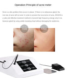 Anti-Acne Apparatus Anti-Mite Beauty Salon Reduce Acne Acne Smallpox Diluting Reduce Dull Balance Grease