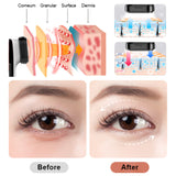 Home Use Rf Beauty Instrument Led Anti Wrinkle Rf Face Lift Machine Rf Facial Beauty Device for Lifting Tighten Skin Ems Facial