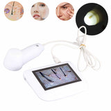 5 Inch Rechargeable Scalp Hair Follicle Oil Moisture Magnifying Detector Analyzer Skin Pigment Tester