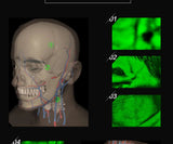HD 2MP Adjustable Vein Viewer w/ Infrared Lights & USB Camera for Adults and Children - Medical IV Finder Imaging Solution
