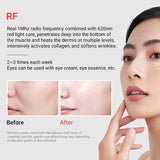Handheld Skin Tightening Facial Neck Lifting Device EMS Microcurrent Home Use RF Beauty Instrument Radiofrecuencia Facial Tools