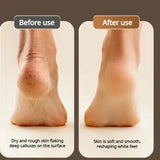 Electric Feet Sander hine Rupture Trimmer Dead Skin for Heels Foot Care Grinding Pedicure Tools Recharge Remover Callus