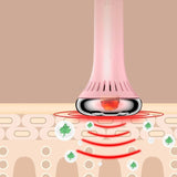 Moxibustion box vibration massage instrument less with fumigation temperature moxibustion apparatus spot beauty