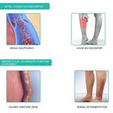1Pair Medical Compression 30-40mmHg Middle Tube Thin Calf Sleeve Peep-to Socks Pressure Varicose Veins Stockings For Woman