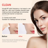 Handheld Skin Tightening Facial Neck Lifting Device EMS Microcurrent Home Use RF Beauty Instrument Radiofrecuencia Facial Tools