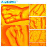 High-Definition USB Vein Viewer Accurate Blood Vessel Imaging in Adults and Children - Ideal for Medical Procedures