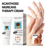 2pc Whiten Acanthosis Nigricans 50g Whitening Moisturizing Dark Spot Correcting for Knuckles Fixderma Nigrifix Cream