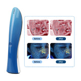 Acne Removal LED Plasma Beauty Device Whitening and Brightening Ozone Cold Plasma Beauty Device Multifunctional Facial Skin Care