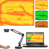 HD 2MP Adjustable Vein Viewer w/ Infrared Lights & USB Camera for Adults and Children - Medical IV Finder Imaging Solution