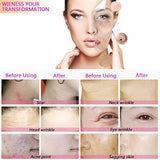 3 in 1 Diamond Microdermabrasion Dermabrasion Machine Water Spray Exfoliation Beauty Machine Removal Wrinkle Facial Peeling SPA