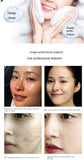 Magic Oxygen Bubble Machine Deep Clean Tender White Skin Cleansing Mites Beauty Facial Rejuvenation Japan Management Device