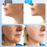 Microcurrent RF Neck Face Beauty Instrument Facial Lifting Machine EMS Face Massager Anti Wrinkle Skin Tighten Sagging Skin Care