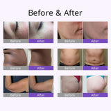 Professional 4 in 1 S Shape Cavitation Radio Frequency Skin Rejuvenation Face Lifting Vacuum RF Slimming Machine