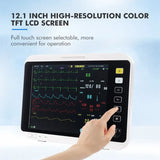 Portable Veterinary Ecg Spo2 Monitoring Equipment Multiparameter Medical Pet Veterinary Monitor