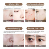 Portable 9 in 1 Facial Care Skin Equipment Peel Firming Dermabrasion Oxygen Jet Facial Care Machines Hydra Bubble Beauty Machine