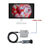 All-in-One USB Portable Endoscope - Flexible Borescope with Adjustable Light, for Industrial & Medical Diagnostics