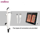 Medical 2.2 2.4 2.8mm Flexible Endoscope Fiber Optic Video Bronchoscope ENT Nasal Disposable Endoscope