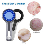 Woods Lamp Skin Analyzer For Skin UV Magnifying For Beauty Facial Testing Wood Lamp Light Skin Analysis Detection Personal Care