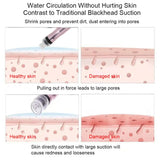 home facial cleansing machine facial blackheads whiteheads remover beauty device faciales skin care bubble beauty device