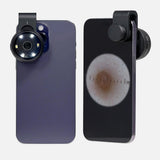 Dermatology DE-300 6X Skin Magnifier Dermoscopy Dermatoscope Dermascope