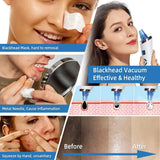 6 In1 Heads New Best Facial Handheld Electric Pore Nose Acne Vacuum Blackhead Remover for Home Use