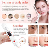 Home Beauty instrument Electric Plasma Pen Facial Care Removal Blackhead Dark Spot Pigment An Eye Lifting Beauty Skin Care Tool