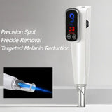 Portable Tattoo Removal Machine Beauty Dent Removal Tool Small Wireless Remove Tattoos Equipment Woman Tattoos Remover Machines