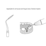 Professional Lab Scaler Tip Periodontal Implant Cleaning Tip Fit for Labs Ultrasonics Handpiece