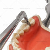 M Lab Matrix Holder Forcep Matrices Placing Tweezer Tip with T/C  Lab Orthodontics Matrics Forcep Dentist Surgicals Instruments