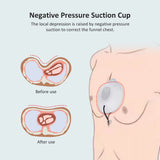Pectus Excavatum Orthosis Brace, Sternal Depression Support, Thoracic Depression Brace, Sunken Sternum Brace for Correction