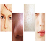 Professional korea whitening acne removal oxygen jet facial machines oxygen beauty facial machines