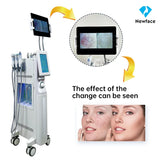 Multi-Function Beauty Tool: Large Bubble Suction, Ice Hammer & Ultrasonic Wave for Blackhead Hydration
