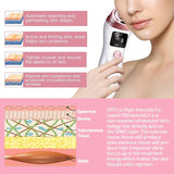 Home Beauty Mini HIFU Machine Ultrasonic RF EMS Facial Lifting Skin Tightening Device Face Chin Neck Eye Anti Wrinkle Massager