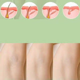 Multi-functional Household Painless Hair Removal Device Electric Beauty Hair Removal Devices Portable Professional Body Epilator