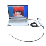 ODM Customization New Portable Veterinary Endoscope Gastrointestinal Endoscopy Pet Surgery High-definition USB Camera System