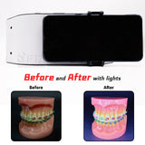 Professional Flash Lab Photography Light Cutting Edge LED Lamp Designed Dentists Equipment Provide Optimal Lighting Oral Filling