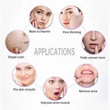 New 6 In 1 Facial Diamond Microdermabrasion Skin Rejuvenation Cuticle Exfoliators Acne Scar Removal Machine